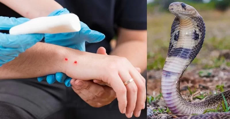 How to Deal with Snake Bites and First Aid Response – Safety Tips and Prevention