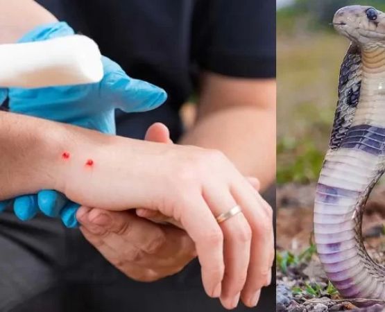 How to Deal with Snake Bites and First Aid Response – Safety Tips and Prevention